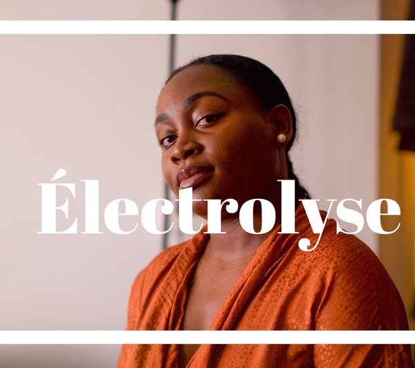 electrolyse épiliation définitive apres deux ans de traitement mon avis mes retours les pours et les ocntres