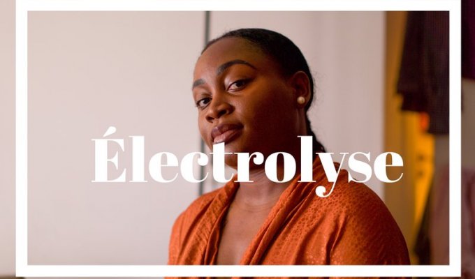 electrolyse épiliation définitive apres deux ans de traitement mon avis mes retours les pours et les ocntres