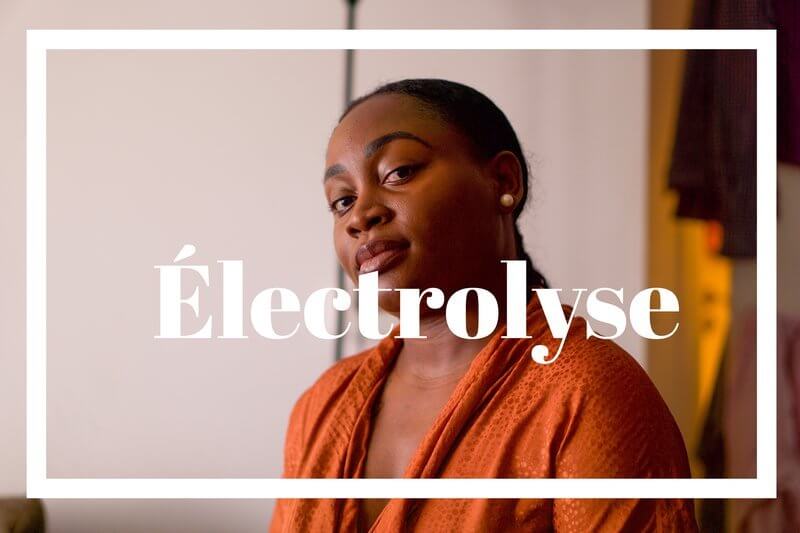 electrolyse épiliation définitive apres deux ans de traitement mon avis mes retours les pours et les ocntres