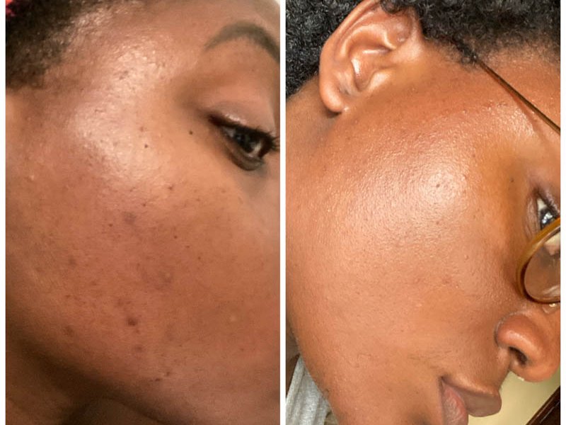 beauté peaux mixtes à imperfections acné nubiance dermocosmetique la revue