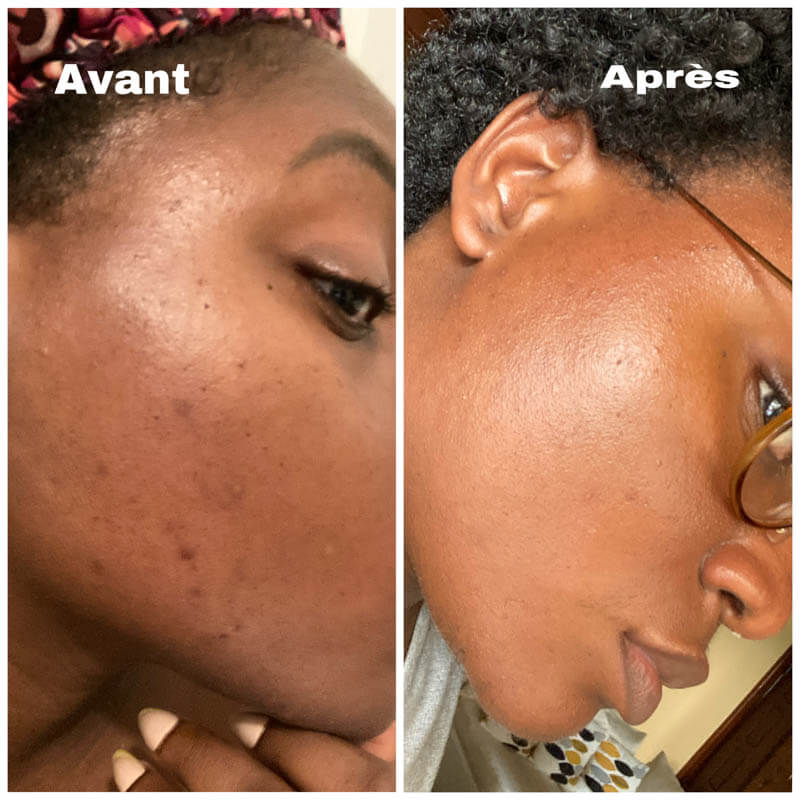 Avant et après routine Nubiance